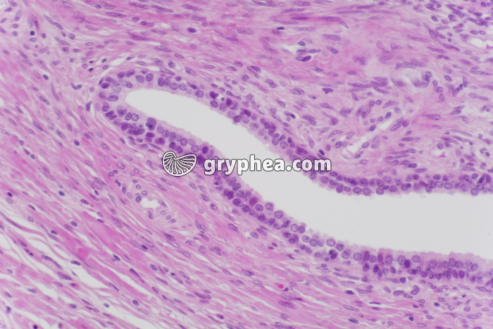 Prostate x100 - gryphea.org